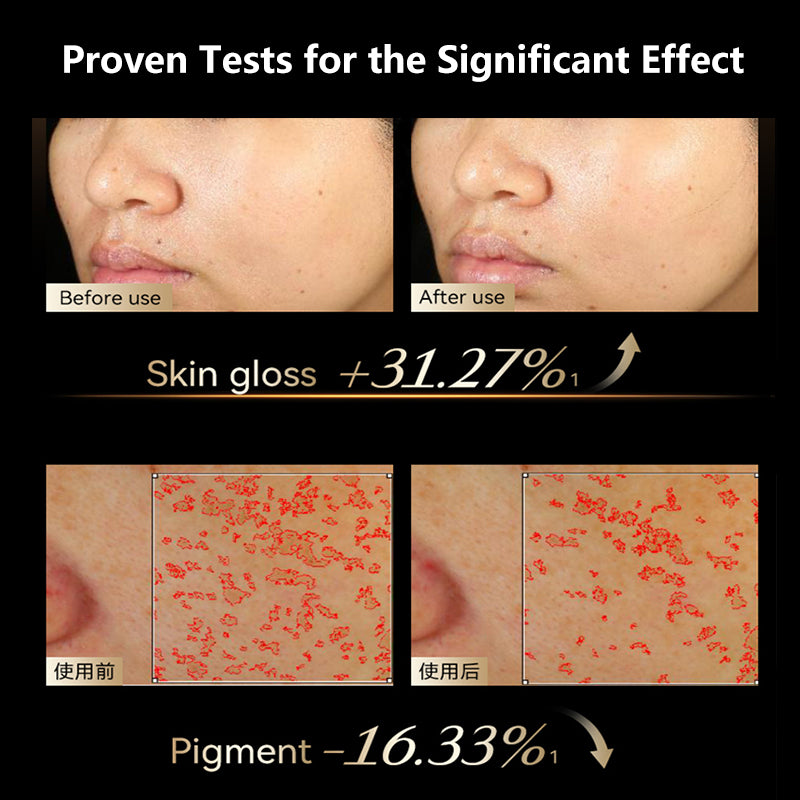 SENNEY Milk Collagen Light Beauty Device