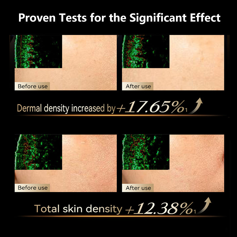 SENNEY Milk Collagen Light Beauty Device